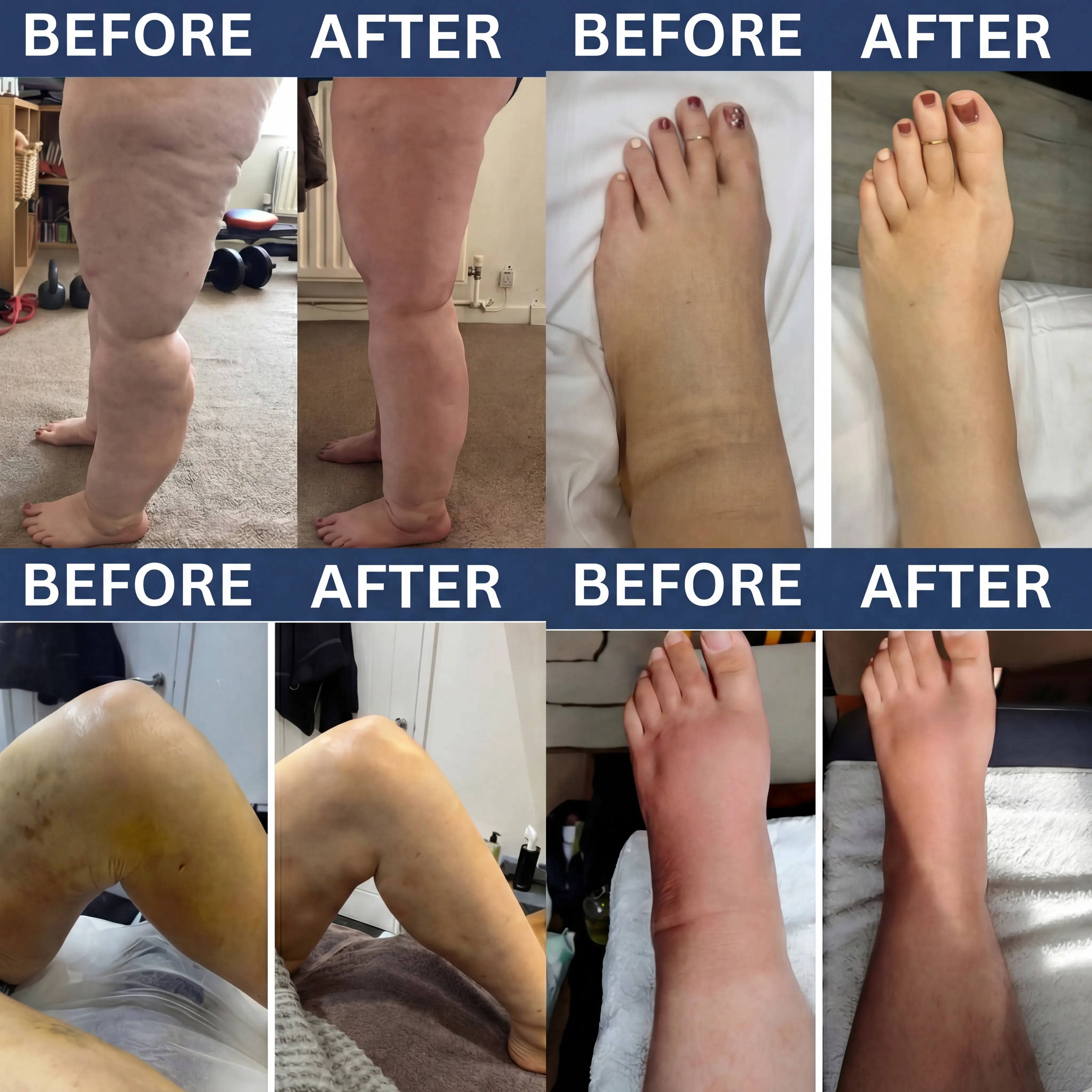 RejuCore™ 3-in-1 Leg Massager - Relief for Swelling & Poor Circulation